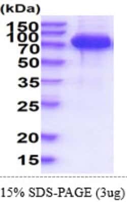 Novus Biologicals&trade;&nbsp;Recombinant Human SLP-76/LCP2 Protein